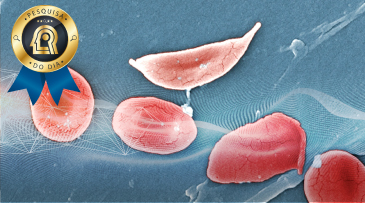 Doença Falciforme é tema de obra premiada, financiada pelo CNPq